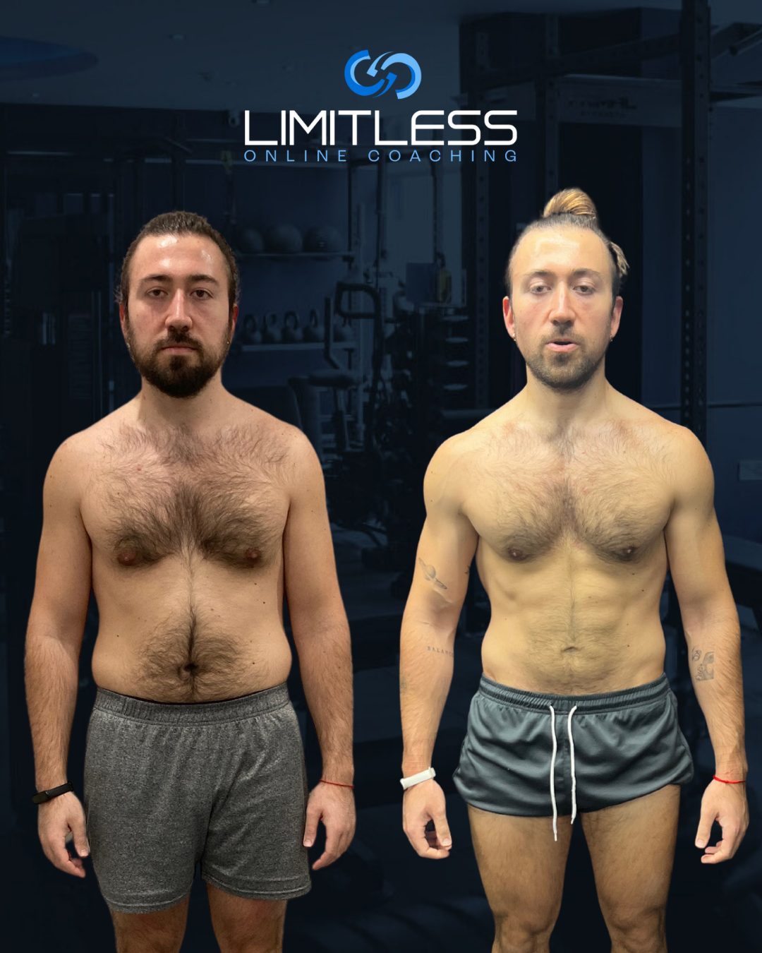 Altug before and after